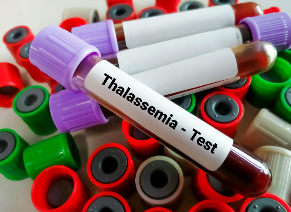 What is the genetic probability of thalassemia? – Baby & Me